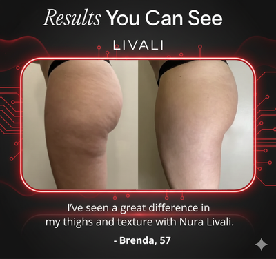 Livali Red Light Thigh Sculpting Band